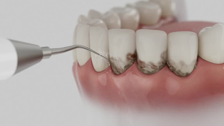 Trusted Teeth Whitening service in West Monroe, MI - Dentist Open Now
